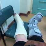 broken-ankles